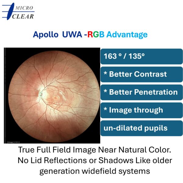 MicroClear Apollo Ultrawidefield RGB - Image 3
